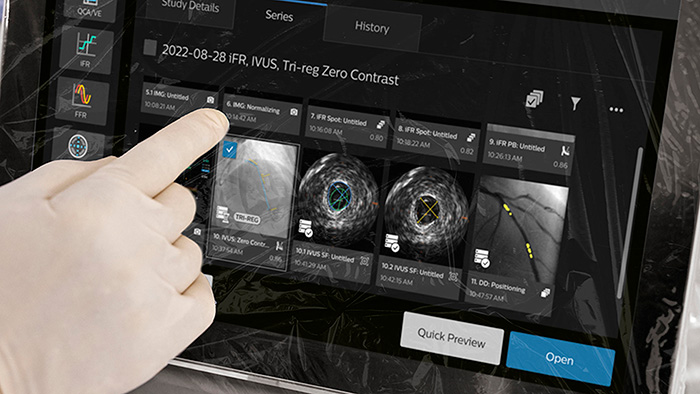 Philips highlights advances in imaging and physiology to support complex PCI at EuroPCR 2026